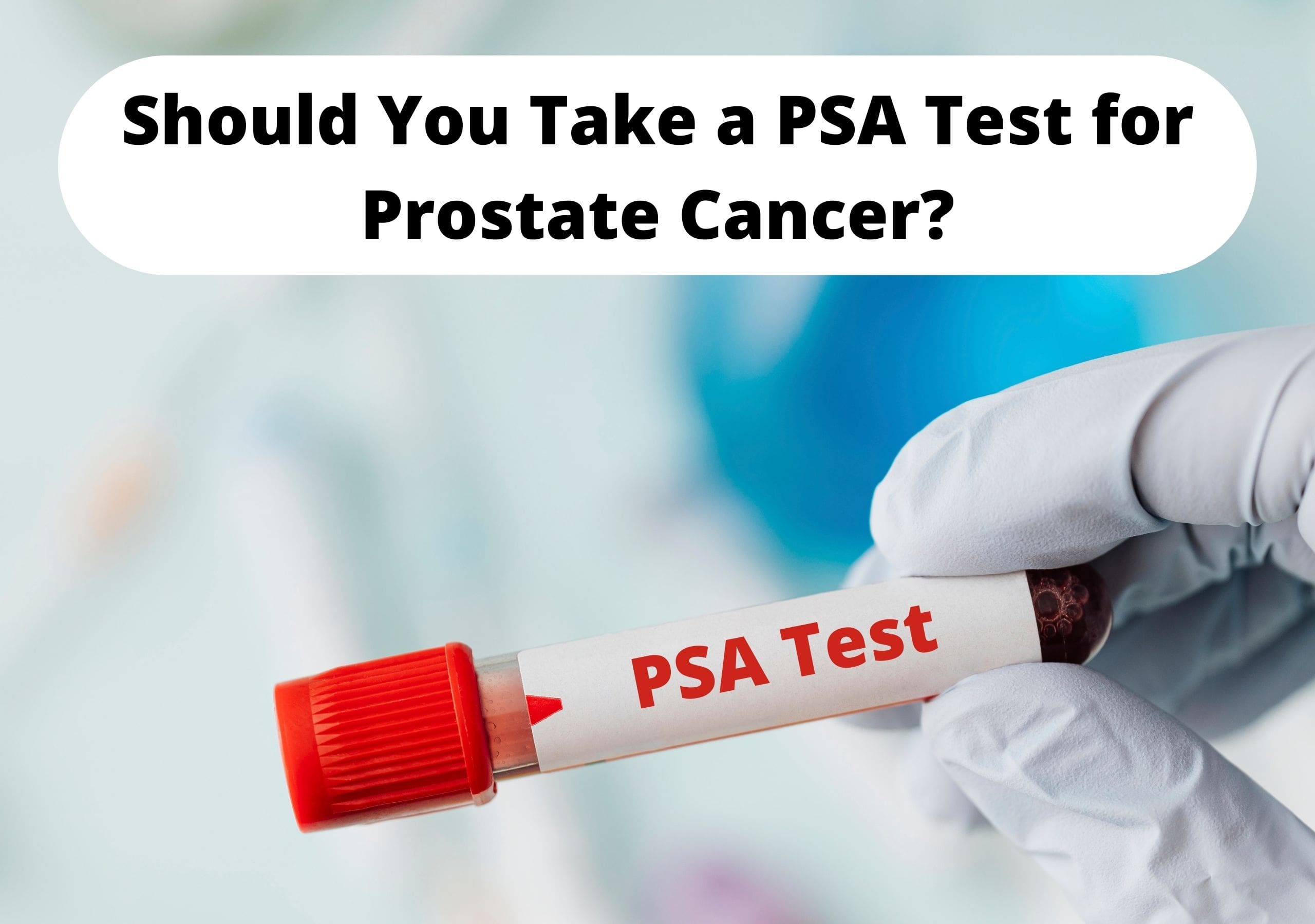 PSA test for Prostate Cancer
