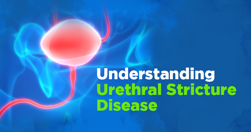 What Is The Meaning Of Stricture Of The Urethra