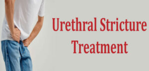 Urethral Stricture treatment