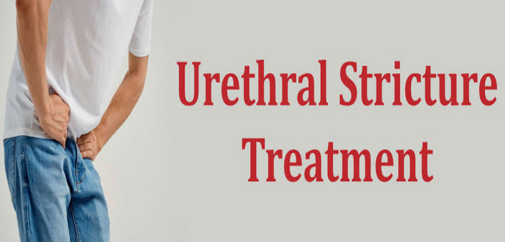 Urethral Stricture Surgery Name