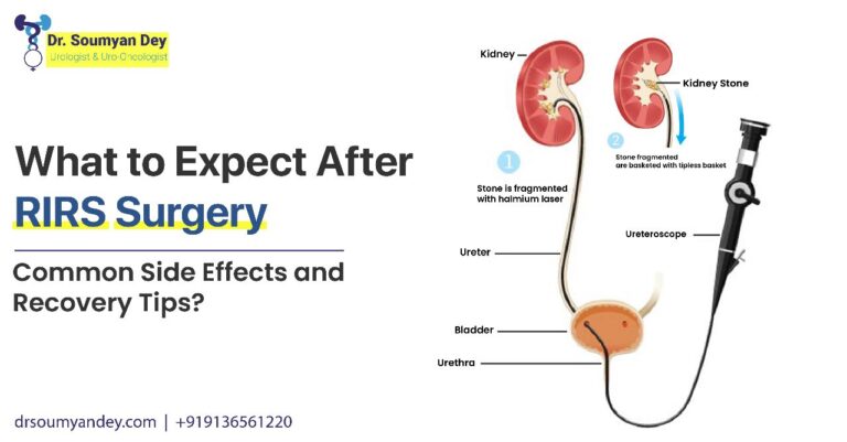 What to Expect After RIRS Surgery_ Common Side Effects and Recovery Tips