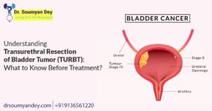 Understanding Transurethral Resection of Bladder Tumor (TURBT): What to Know Before Treatment