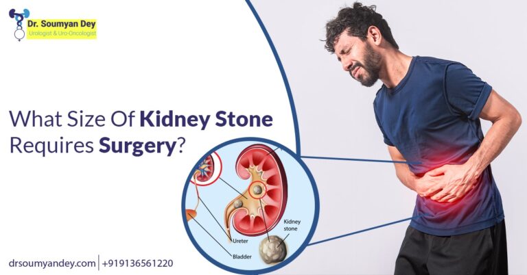 What Size Of Kidney Stone Requires Surgery
