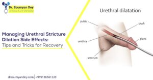 Managing Urethral Stricture Dilation Side Effects: Tips and Tricks for Recovery