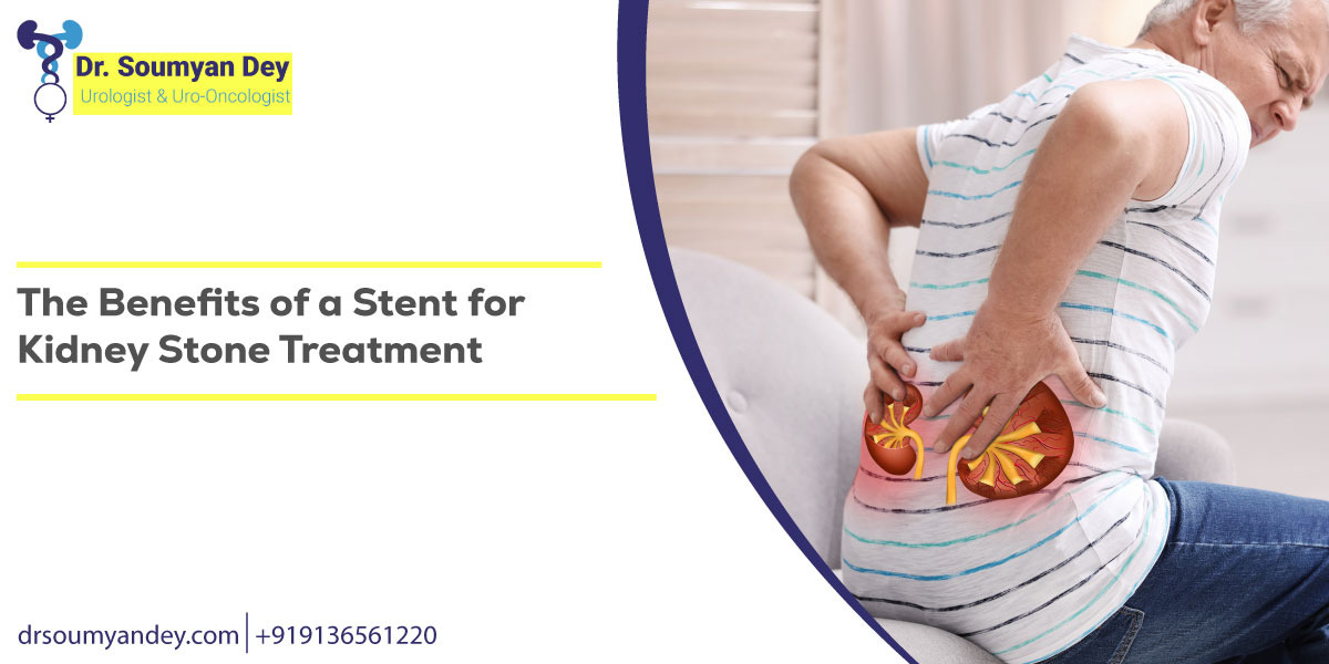 The Benefits of a Stent for Kidney Stone Treatment