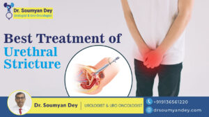 Best Treatment of Urethral Stricture