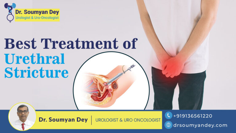 Best Treatment of Urethral Stricture
