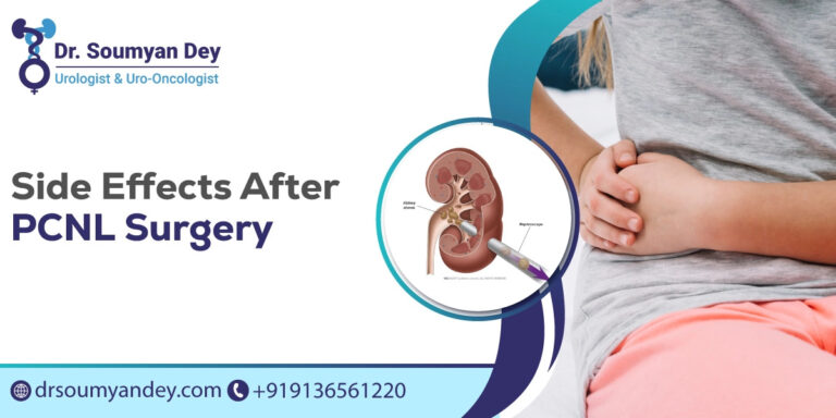 Side Effects After PCNL Surgery
