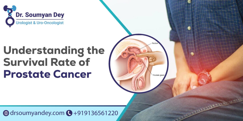 Understanding the Survival Rate of Prostate Cancer