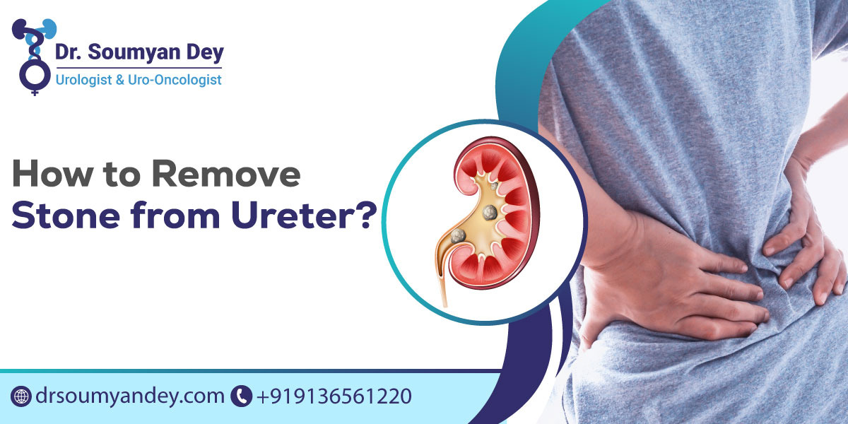 how to remove stone from ureter