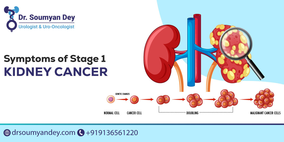 Symptoms of Stage 1 Kidney Cancer