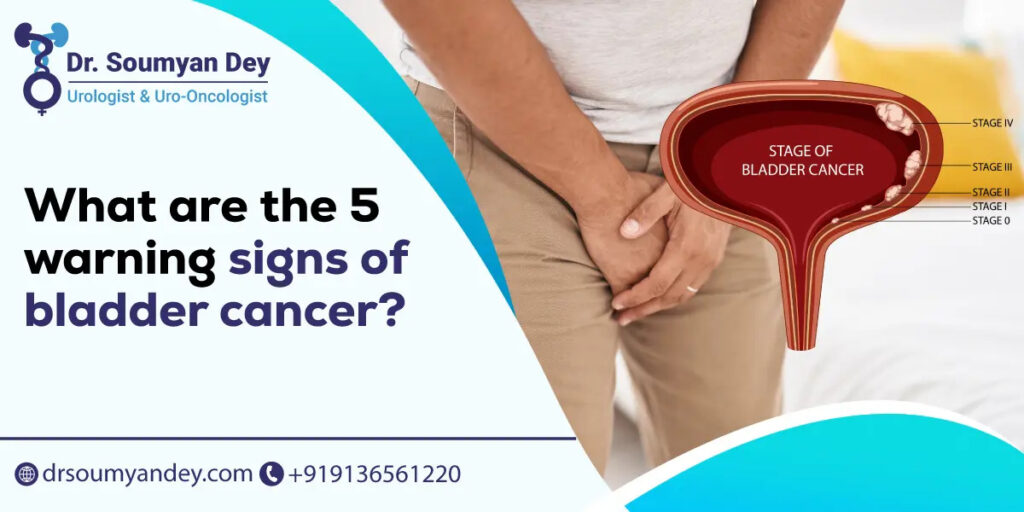 What are the 5 warning signs of bladder cancer
