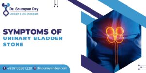 Symptoms of Urinary Bladder Stone