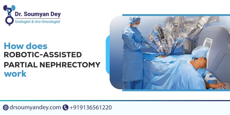 partial nephrectomy