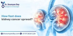 How Fast Does the Kidney Cancer Spreads?