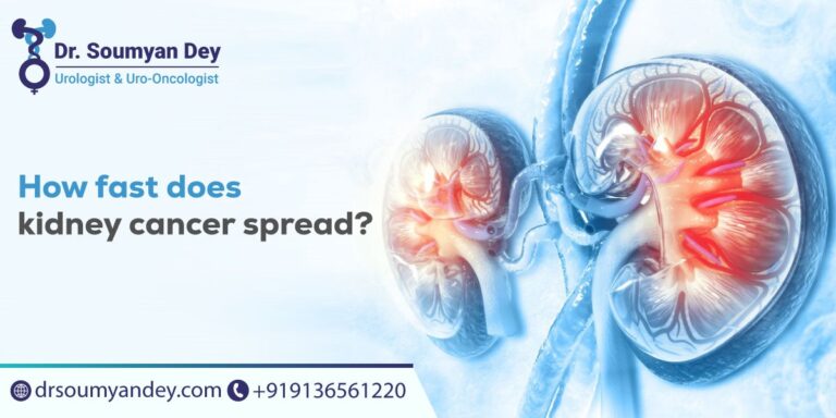 How Fast Does Kidney Cancer Spread