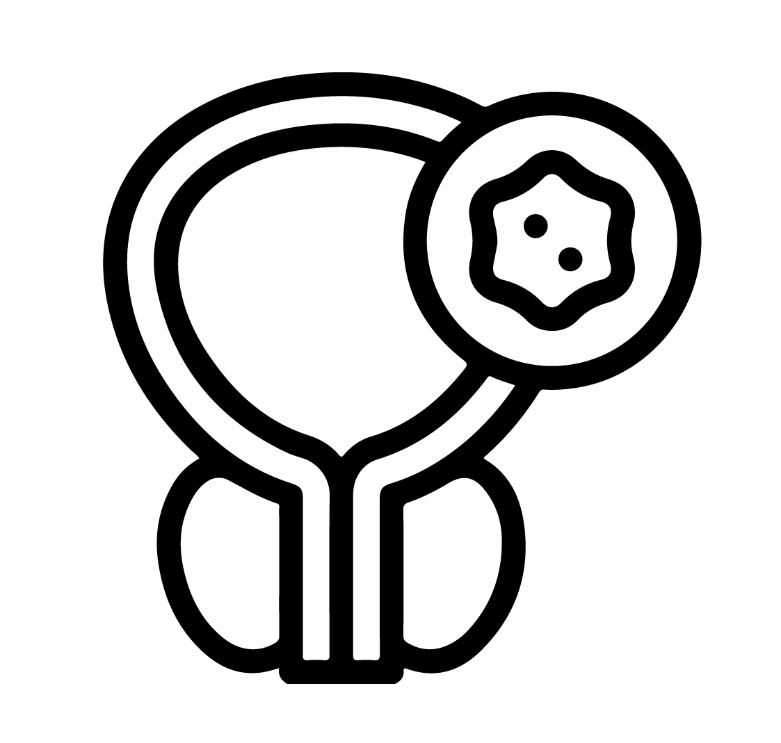 prostate cancer treatment