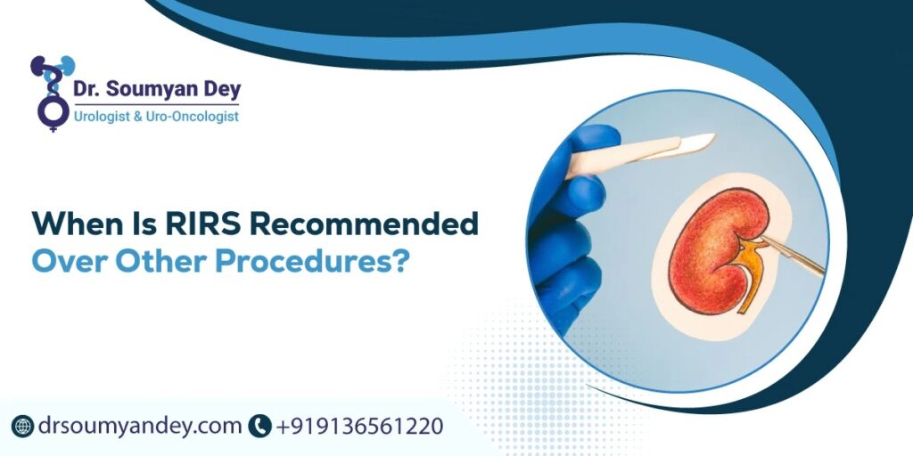 When Is RIRS Recommended Over Other Procedures