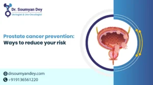 Can-Prostate-Cancer-be-Prevented