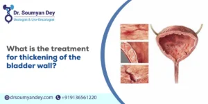What is the Treatment for Thickening of the Bladder Wall?