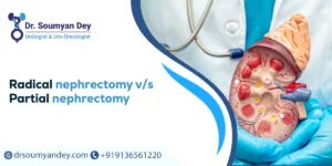 Radical Nephrectomy vs Partial Nephrectomy
