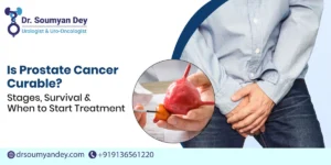 Is Prostate Cancer Curable? Stages, Survival & When to Start Treatment
