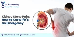 Kidney Stone Pain: How to Know If It’s an Emergency