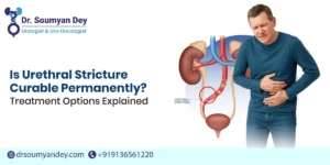 Is Urethral Stricture Curable Permanently?