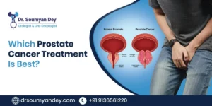 Which Prostate Cancer Treatment Is Best
