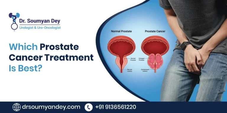 Which Prostate Cancer Treatment Is Best