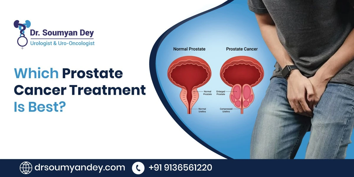 Which Prostate Cancer Treatment Is Best