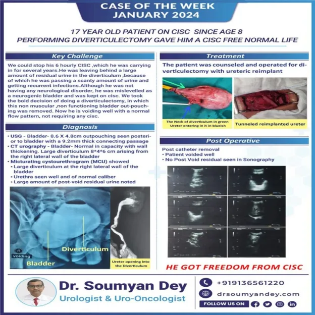 Bladder diverticulectomy with ureteric reimplantation case treated by Dr Soumyan Dey