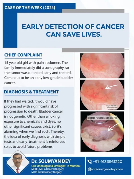 Early low-grade bladder cancer detected and treated by Dr Soumyan Dey