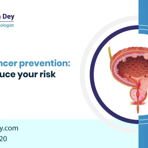 Can Prostate Cancer be Prevented?