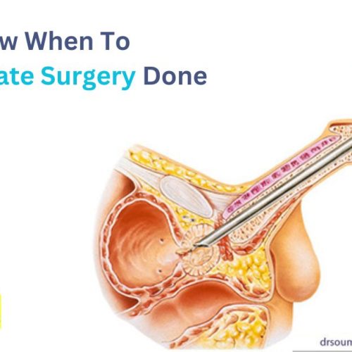 Prostate Cancer Surgery In Navi Mumbai