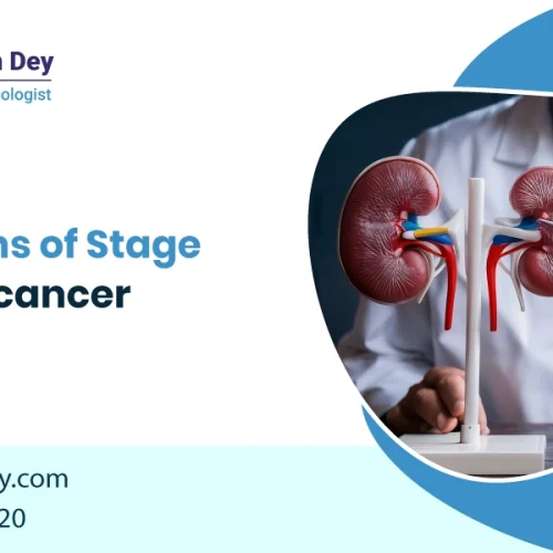 Stage 4 Kidney Cancer: Symptoms, Treatment, and Life Expectancy