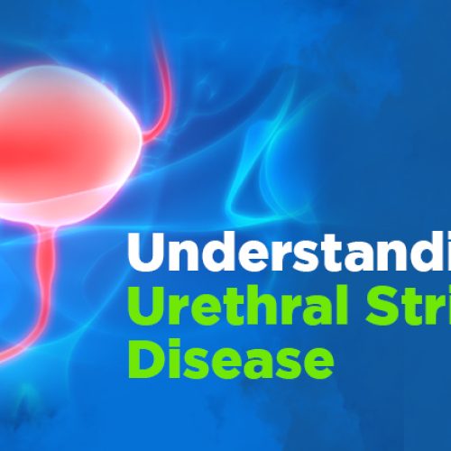 Urethral Stricture Disease