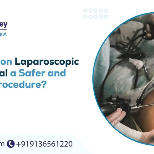 Single-Incision Laparoscopic