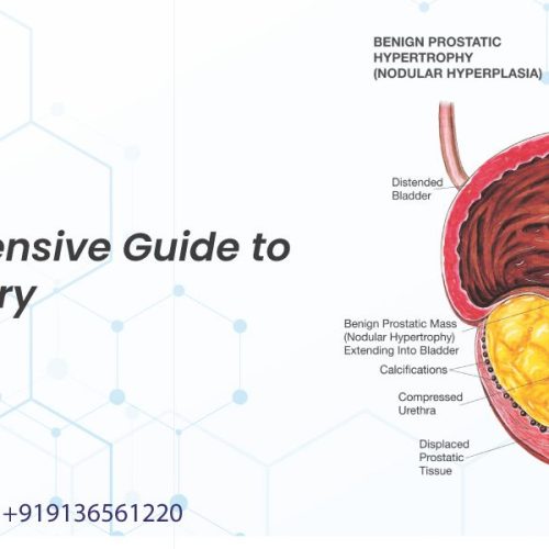 a comprehensive guide to holep surgery