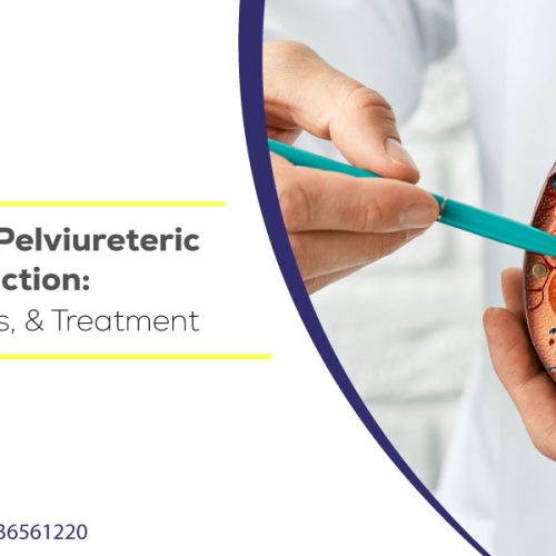 An Overview of Pelviureteric Junction Obstruction: Causes, Symptoms, and Treatment