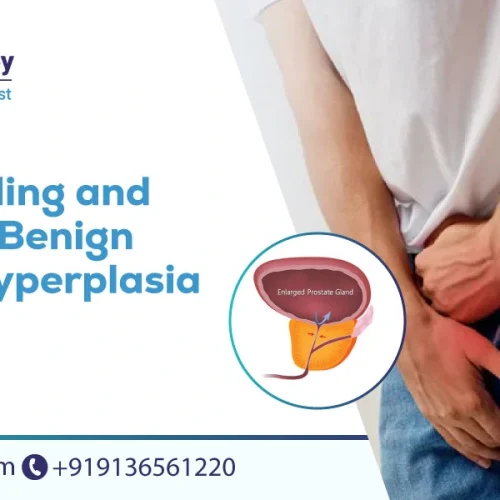 benign prostatic hyperplasia (bph)