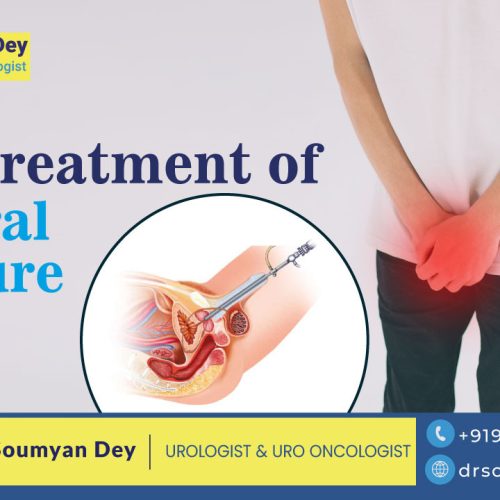 best treatment of urethral stricture