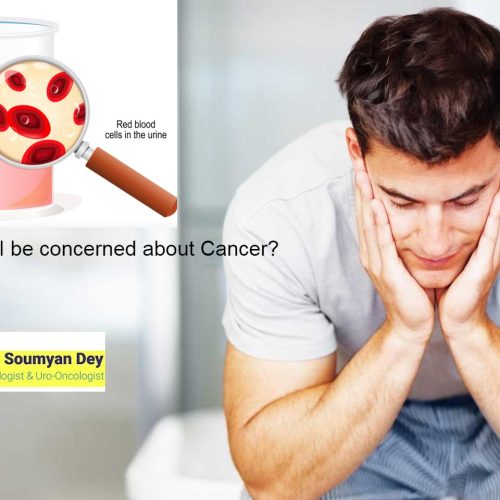 Blood Clots in Urine