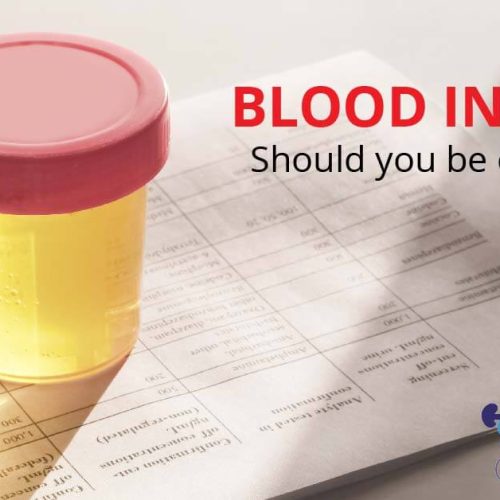Blood In Urine(Hematuria): What Does it Mean?