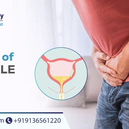 cause of uti in male