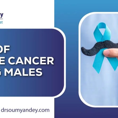 Causes of prostate cancer in young males