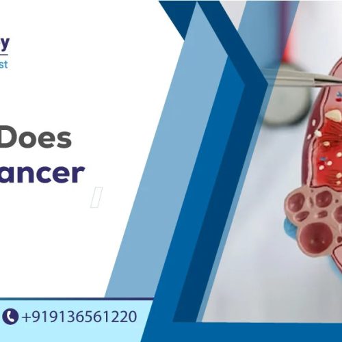 how fast does bladder cancer spread