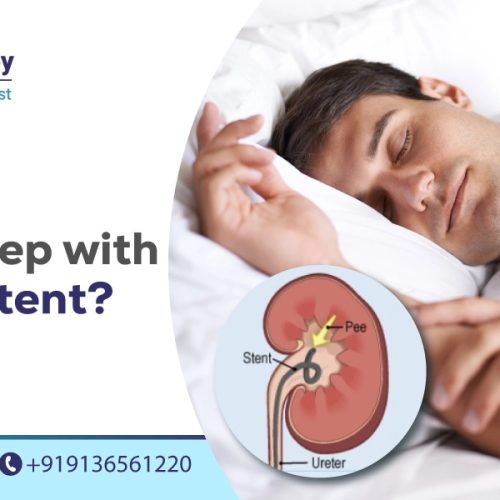 how to sleep with a kidney stent
