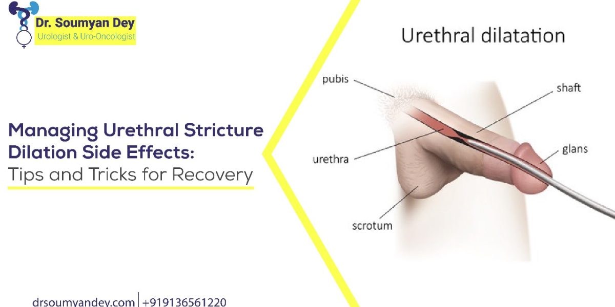 Managing Urethral Stricture Dilation Side Effects_ Tips and Tricks for Recovery