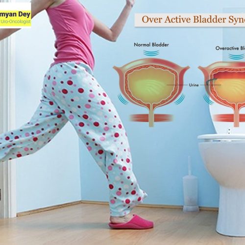 Overactive bladder syndrome